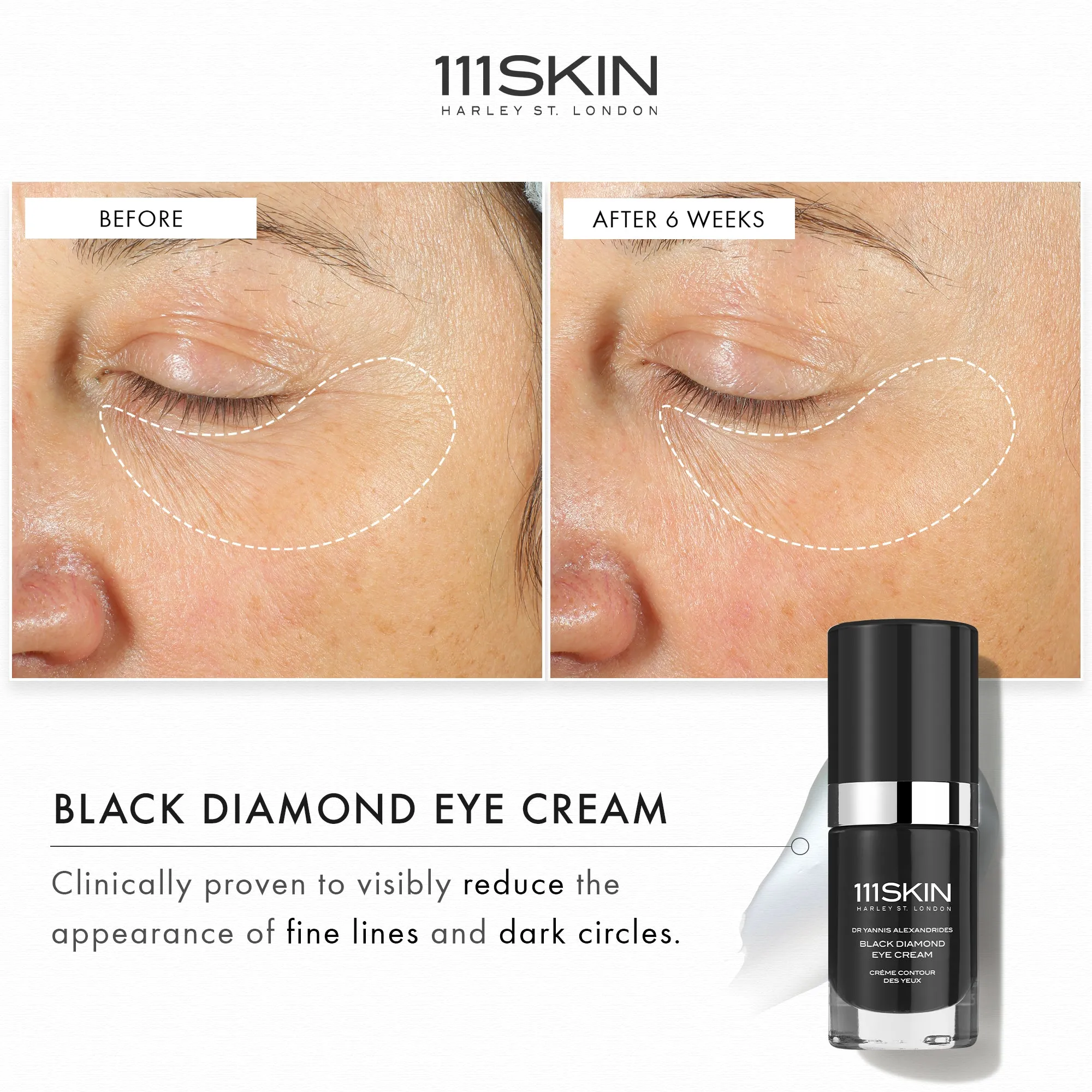 111Skin Black Diamond Eye Cream